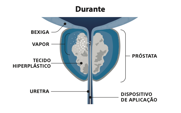 Durante-Rezum