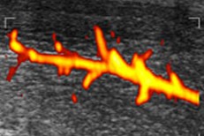 Ecodoppler-Vascular-Colorido-Peniano-nuno-tomada